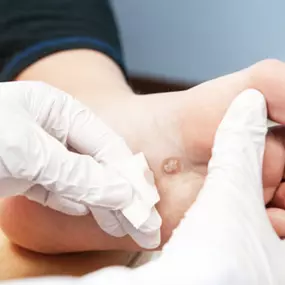 As a trusted foot doctor practice, Equinox Medicine Foot and Ankle Queens focuses on diagnosing and treating various foot-related issues. We provide patient-centered care to ensure that your foot health is maintained, addressing both minor concerns and complex conditions.