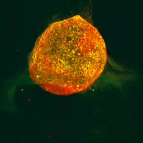 Microimaging novel technology to transform stem cells into insulin producing cells