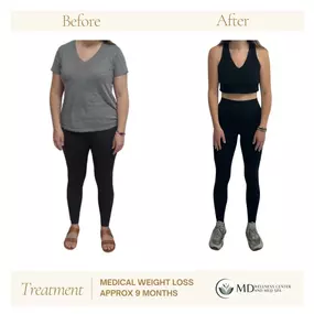 Before & After Medical Weight Loss