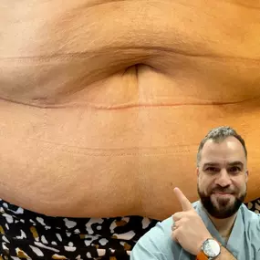 Bild von Sofiane El Djouzi, MD - Bariatric Surgeon