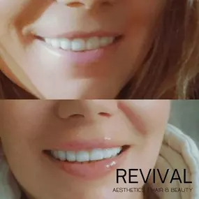 Bild von Revival Aesthetics Hair & Beauty