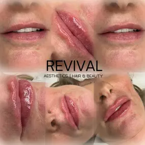 Bild von Revival Aesthetics Hair & Beauty