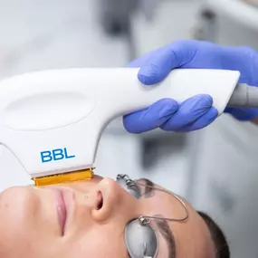 We are proud to offer the advanced Sciton MOXI™ & BroadBand Light™ (BBL™ ) treatment—a revolutionary laser therapy designed to rejuvenate and revitalize your skin.

MOXI™ & BroadBand Light™ (BBL™ ) two advanced skin treatments that pair perfectly for dramatic results with little to no downtime.

Sciton Moxi is the perfect solution for those looking to address early signs of aging, sun damage, and uneven skin tone. This non-invasive treatment is suitable for all skin types and can be customized t