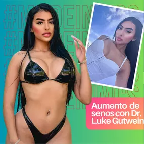 Resultados de Aumento de Senos Antes y Después con el Dr. Luke Gutwein en My Cosmetic Surgery Miami