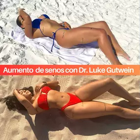 Resultados de Aumento de Senos Antes y Después con el Dr. Luke Gutwein en My Cosmetic Surgery Miami