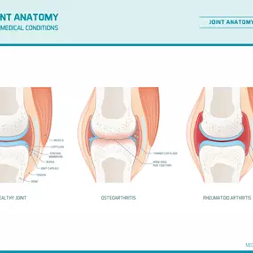 Bild von Shockwave Therapy Clinic UK