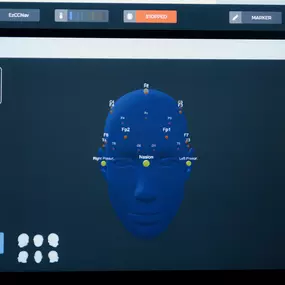 Real-time brainwave monitoring for a neurofeedback session, in order to support cognitive and emotional balance.