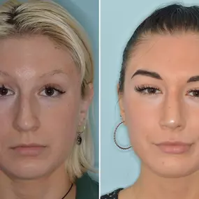 Bild von Facial Plastic Surgery Miami