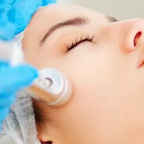 Microneedling