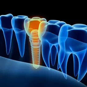 Bild von G & G Dental, Odontología Especializada