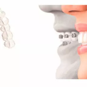 Bild von G & G Dental, Odontología Especializada