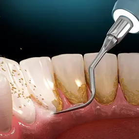 Bild von G & G Dental, Odontología Especializada