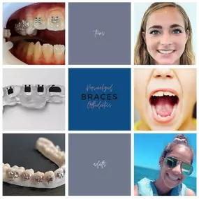 Bild von Personalized Orthodontics Sammamish