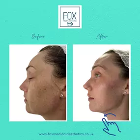 Bild von Fox Medical Aesthetics