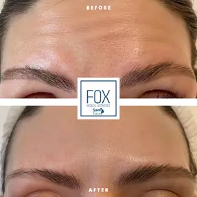 Bild von Fox Medical Aesthetics