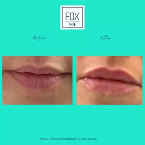 Bild von Fox Medical Aesthetics