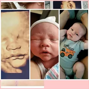 Bild von Chubby Cheeks Ultrasound Studio of Kernersville