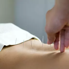Bild von Chloé Frémont - Médecine Chinoise & Hypnose à Nice