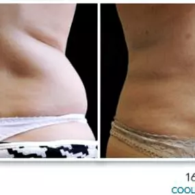 Bild von Hollywood Body & Face Denver/Metro