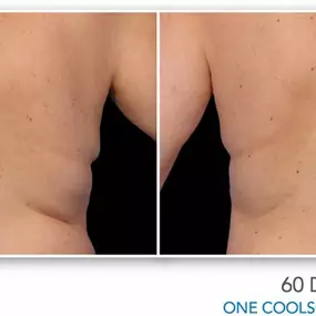 Bild von Hollywood Body & Face Denver/Metro