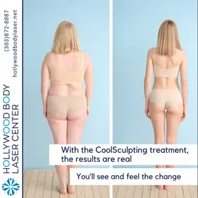 Bild von Hollywood Body & Face Denver/Metro