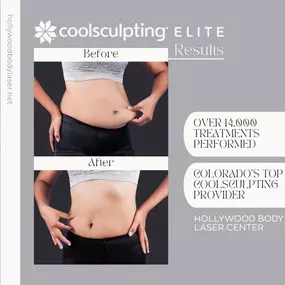 Bild von Hollywood Body & Face Denver/Metro