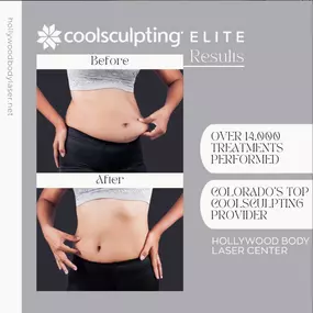 Bild von Hollywood Body & Face Denver/Metro