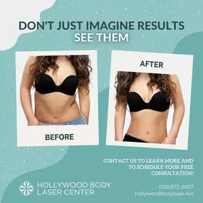 Bild von Hollywood Body & Face Denver/Metro