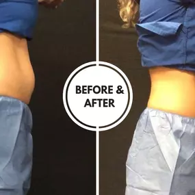 Bild von Hollywood Body & Face Denver/Metro