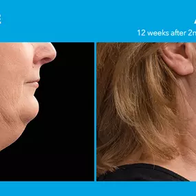 Bild von Hollywood Body & Face Denver/Metro
