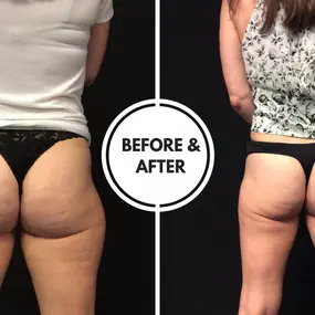 Bild von Hollywood Body & Face Denver/Metro