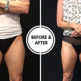 Bild von Hollywood Body & Face Denver/Metro