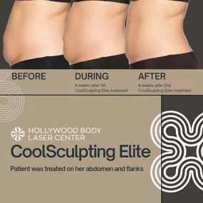 Bild von Hollywood Body & Face Denver/Metro