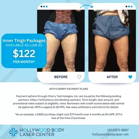 Bild von Hollywood Body & Face Denver/Metro