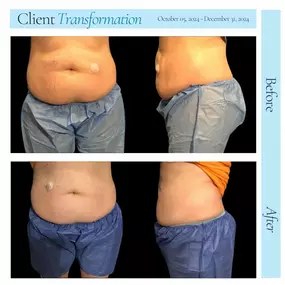 Bild von Hollywood Body & Face Denver/Metro