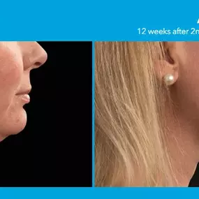 Bild von Hollywood Body & Face Denver/Metro