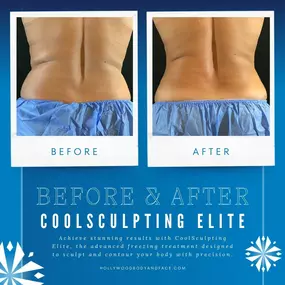 Bild von Hollywood Body & Face Denver/Metro