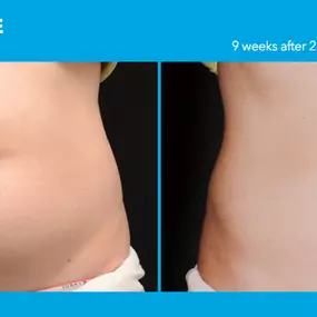 Bild von Hollywood Body & Face Denver/Metro