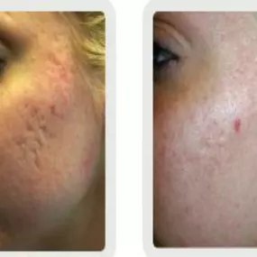 Bild von Hollywood Body & Face Denver/Metro