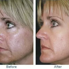 Bild von Hollywood Body Laser Center Colorado Springs