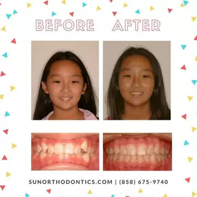 Bild von Sun Orthodontics, Melanie H. Duong, DMD, MS