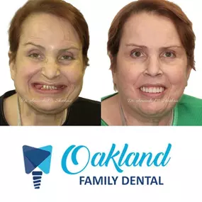 Waterford Twp, MI Cosmetic Dentistry