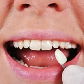 Bild von Maspeth Dental - HL