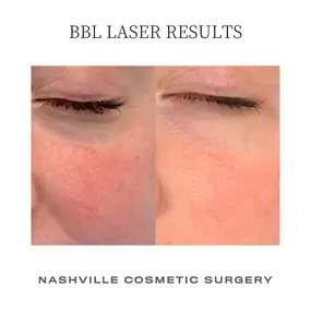 Bild von Nashville Cosmetic Surgery: Don Griffin, MD