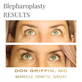 Bild von Nashville Cosmetic Surgery: Don Griffin, MD