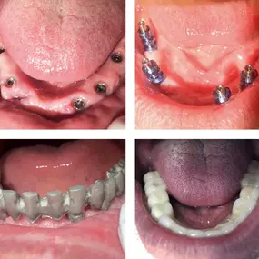 Bild von CV Dental Clínica Riocabado - Dra. Cecilia Vargas Trincheri