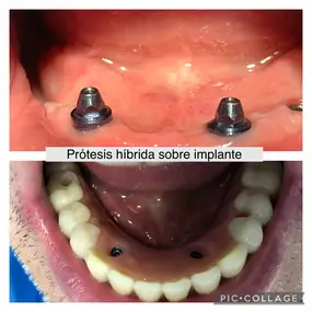 Bild von CV Dental Clínica Riocabado - Dra. Cecilia Vargas Trincheri