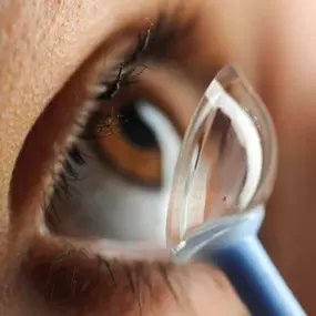 an image of a southland eye associates patient inserting a scleral contacdt lens