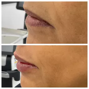 Ridgefield Aesthetics offers advanced aesthetic treatments, including dermal fillers, laser skin revitalization, and body contouring, led by Dr. Zina Boutaeva and her expert team. Prioritizing comfort, safety, and personalized care, they help clients achieve radiant skin and enhanced confidence. Visit us near downtown Ridgefield, CT.