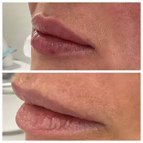 Ridgefield Aesthetics offers advanced aesthetic treatments, including dermal fillers, laser skin revitalization, and body contouring, led by Dr. Zina Boutaeva and her expert team. Prioritizing comfort, safety, and personalized care, they help clients achieve radiant skin and enhanced confidence. Visit us near downtown Ridgefield, CT.